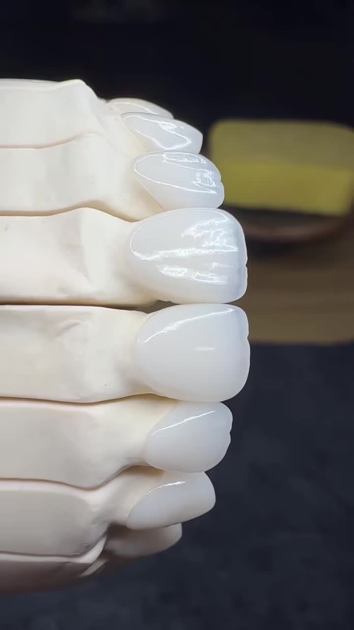 Đố mọi người biết là bọc hay dán sứ nhé