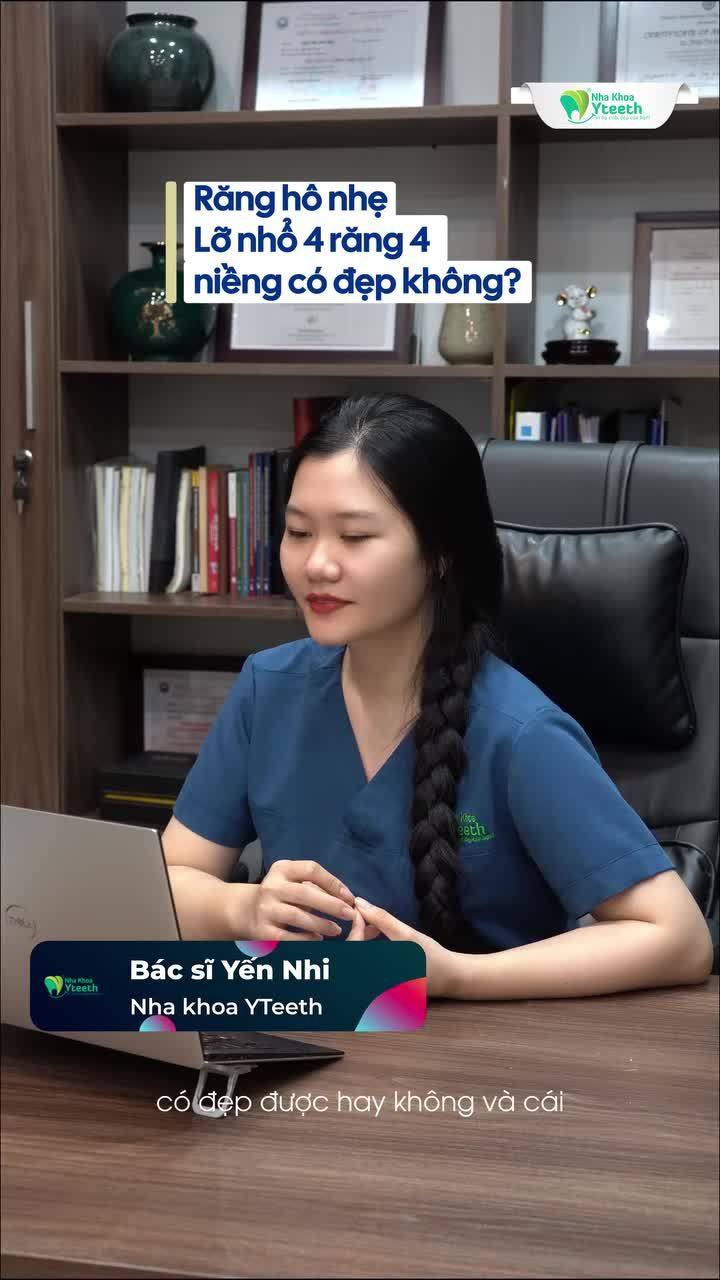 Răng hô nhẹ đã nhổ 4 răng 4 — Niềng xong có đẹp không ?