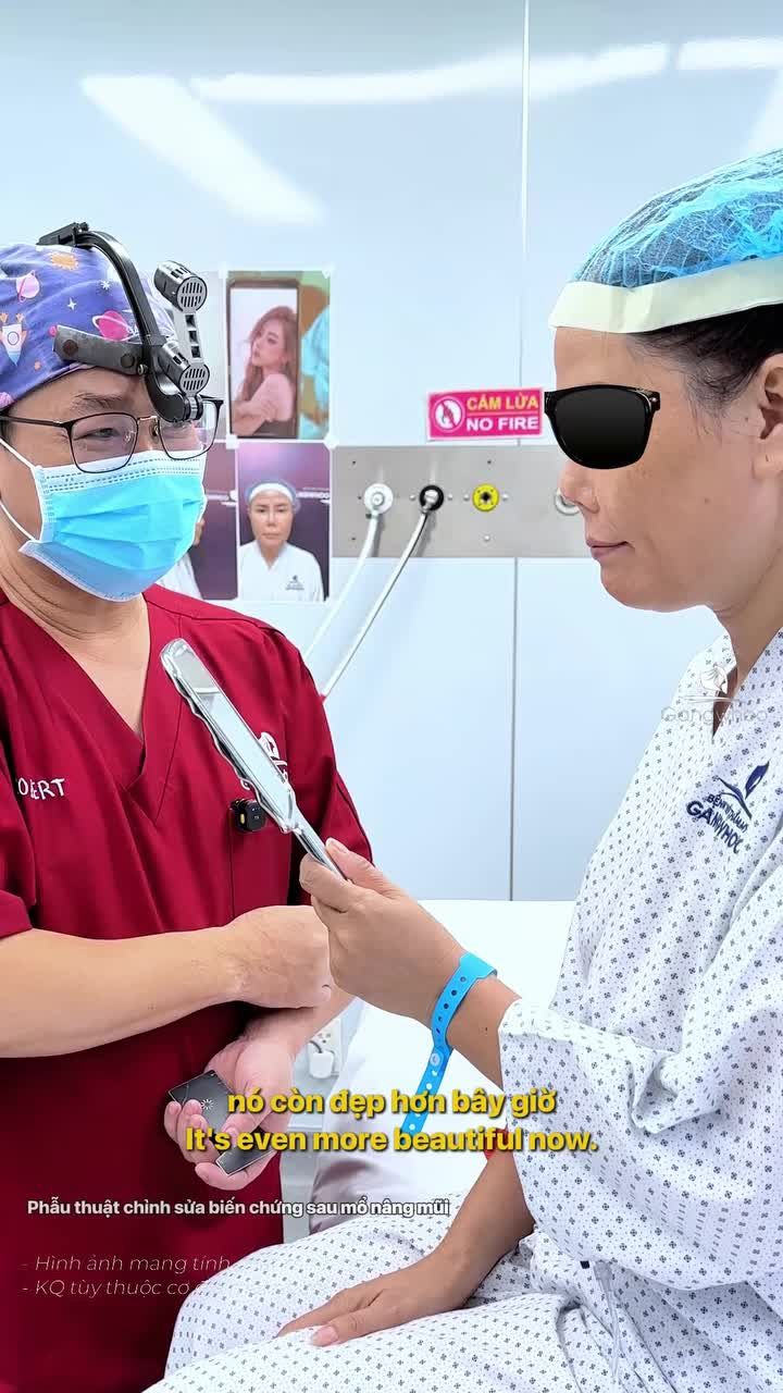 Mũi biến chứng co rút nặng có chỉnh sửa lại được không?