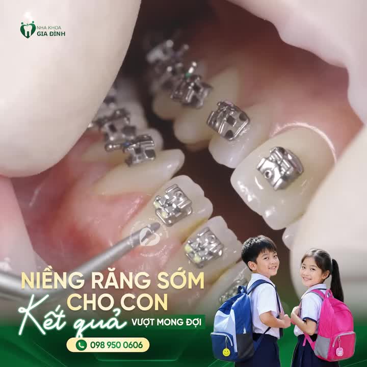 GIÁ TRỊ CỦA VIỆC CAN THIỆP NIỀNG RĂNG ĐÚNG THỜI ĐIỂM
