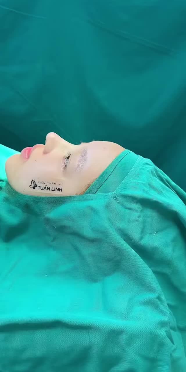 DÁNG MŨI THIẾT KẾ CHUẨN ĐẸP LÀM HÀI LÒNG MỌI KHÁCH HÀNG