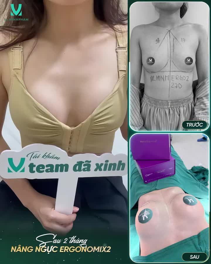 NGẮM NHÌN KẾT QUẢ TÁI KHÁM SAU 2 THÁNG MÀ ĐÃ “ƯNG CÁI BỤNG”