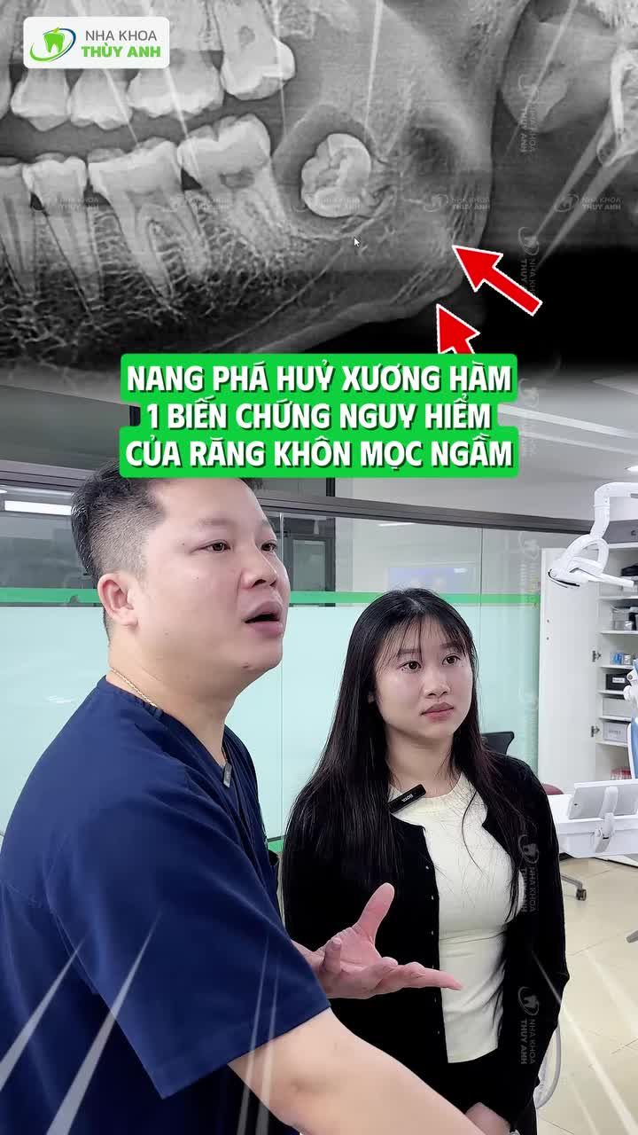 RĂNG KHÔN MỌC NGẦM + NANG QUANH CHÂN RĂNG: BÁC SĨ XỬ LÝ THẾ NÀO?