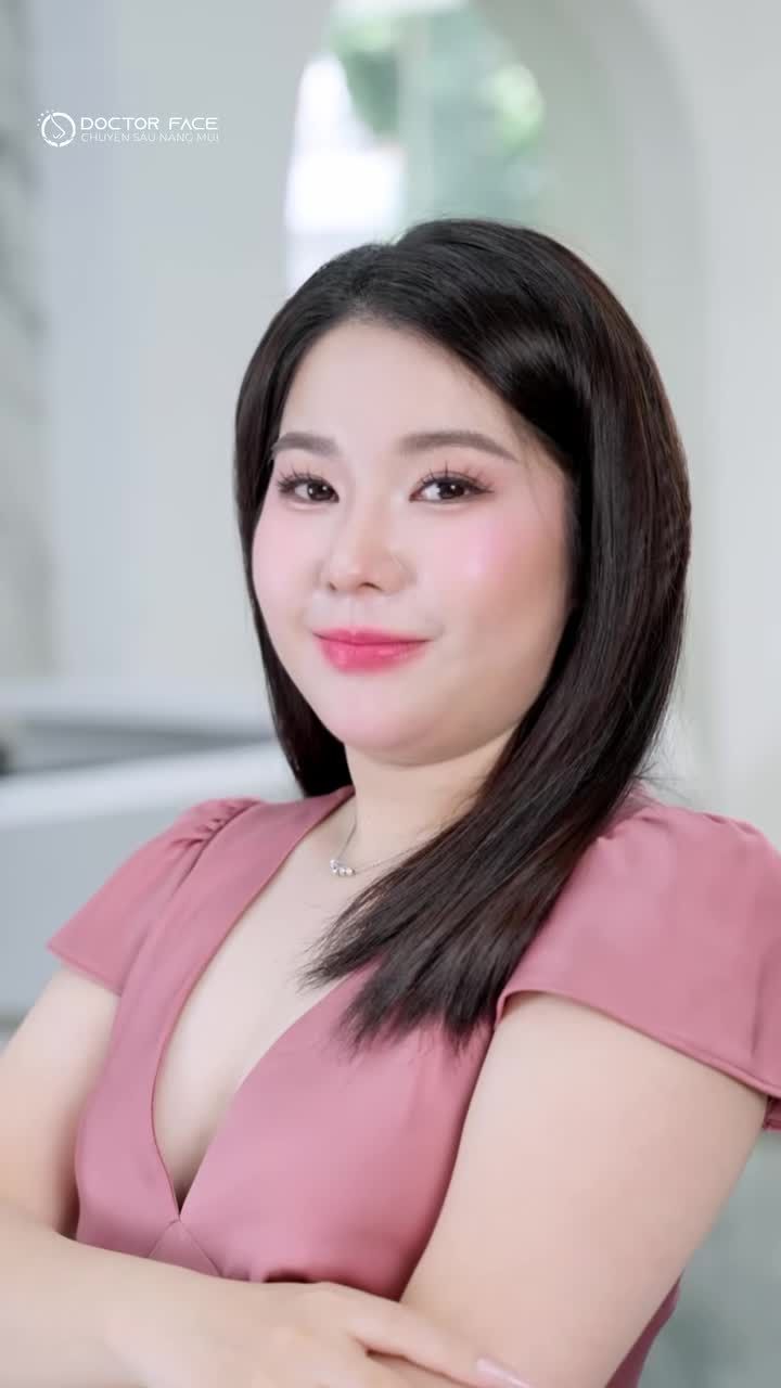 Tái khám sau 1 tháng nâng mũi của nhân viên Dr Face