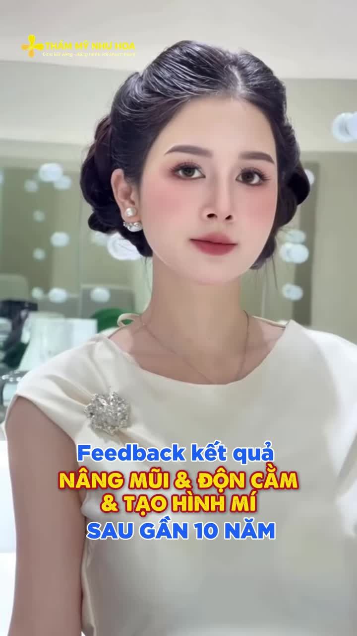 Gần 10 năm trôi qua, dáng mũi, đường nét cằm và đôi mắt của chị đẹp Thu Thủy vẫn hài hòa, tự nhiên - cùng nhìn lại kết quả sau gần một thập kỷ đồng hành cùng Tiến sĩ Tống Hải nhé