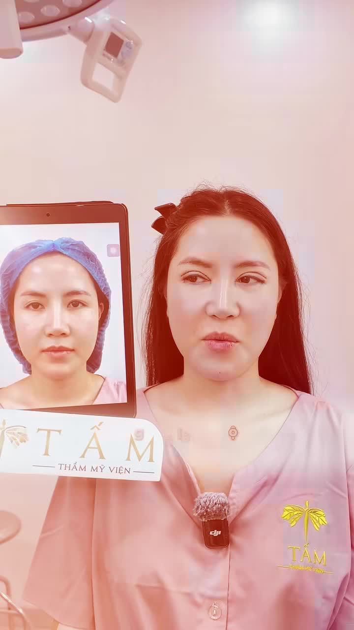 Chị đẹp rất nhát, rất sợ đau nhưng lại khen hết lời tay nghề của Bác Sĩ nhà Tấm. Thế nên nàng nào còn 'rén' thì cứ mạnh dạn đến ngay với Tấm nhé, đảm bảo làm xong chỉ hối hận vì không đi làm đẹp sớm hơn thôi!