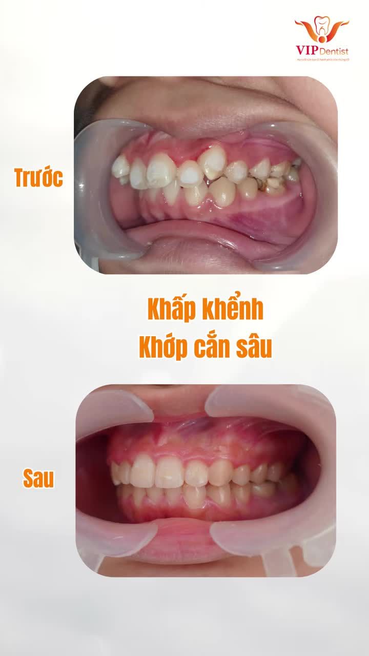 MÀN "BIẾN HÌNH" THÀNH CÔNG RỰC RỠ CỦA CÔ GÁI NHỎ BÉ!