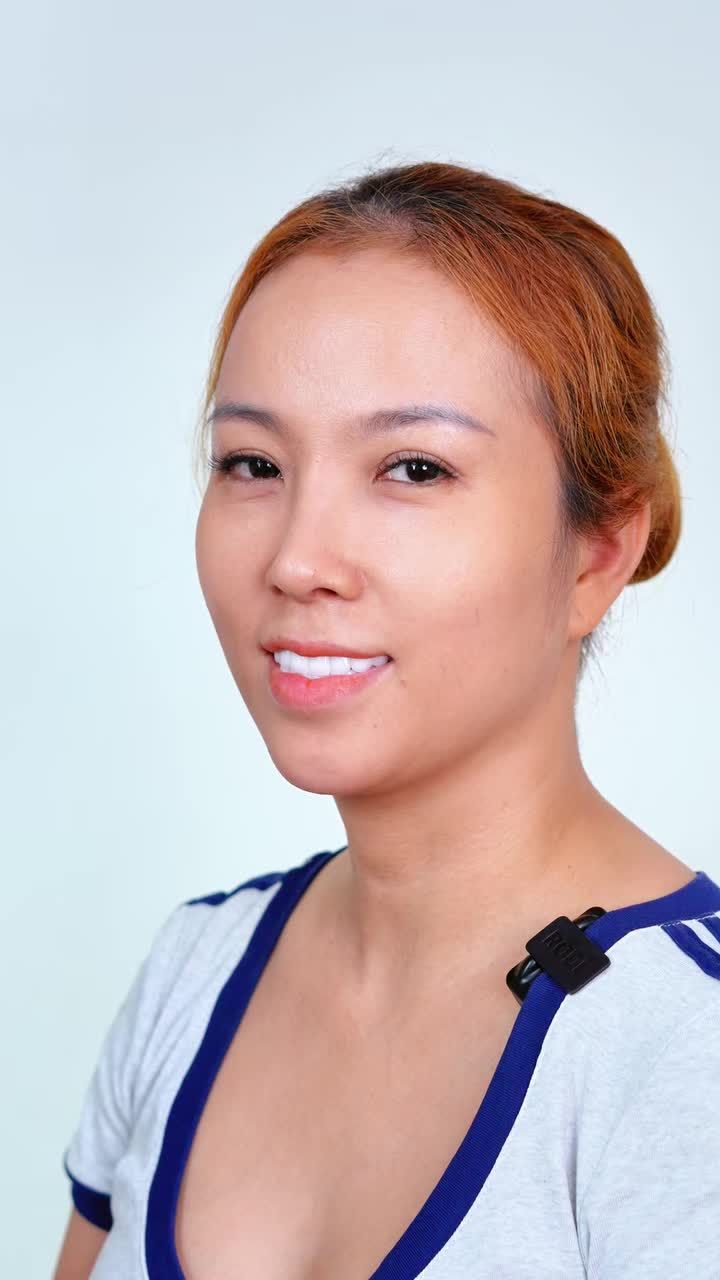 CẢM NHẬN KHÁCH HÀNG TÁI KHÁM: SỬA MŨI HỎNG SAU 6 NĂM – TÁI SINH DÁNG MŨI TỰ NHIÊN, TRẺ RA CẢ VÀI TUỔI!