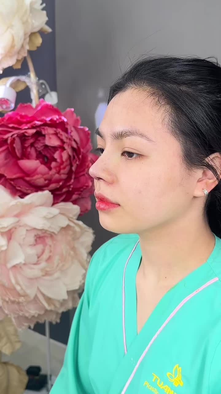 Mũi cấu trúc sau phẫu thuật