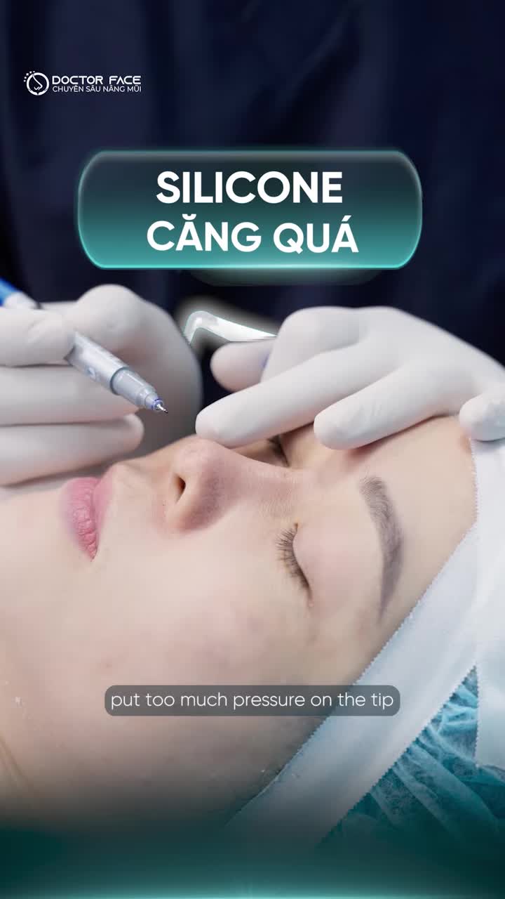 Tháo sụn rồi, mũi đã thực sự ổn?
