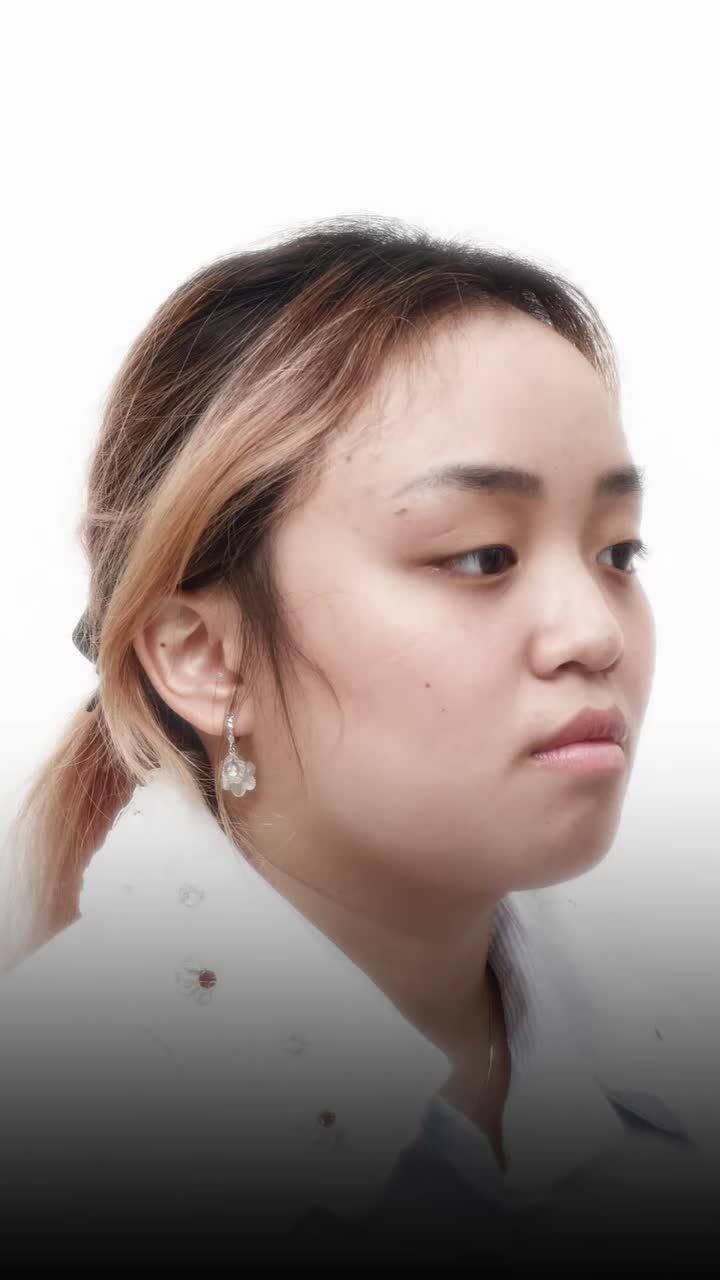 Ưu đãi dành riêng cho sinh viên có ý định nâng mũi trong tháng này!