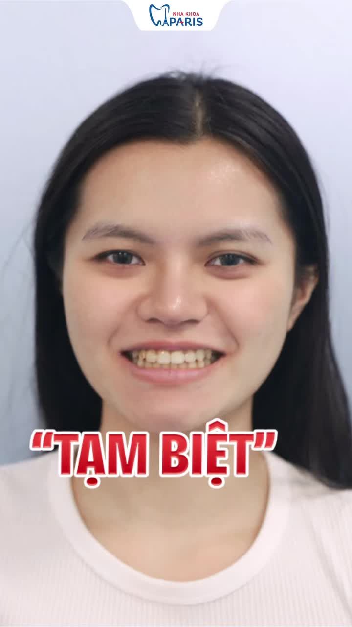 UPDATE NỤ CƯỜI TRẮNG SÁNG – TỰ TIN ĐÓN ĐẠI LỄ 2/9!