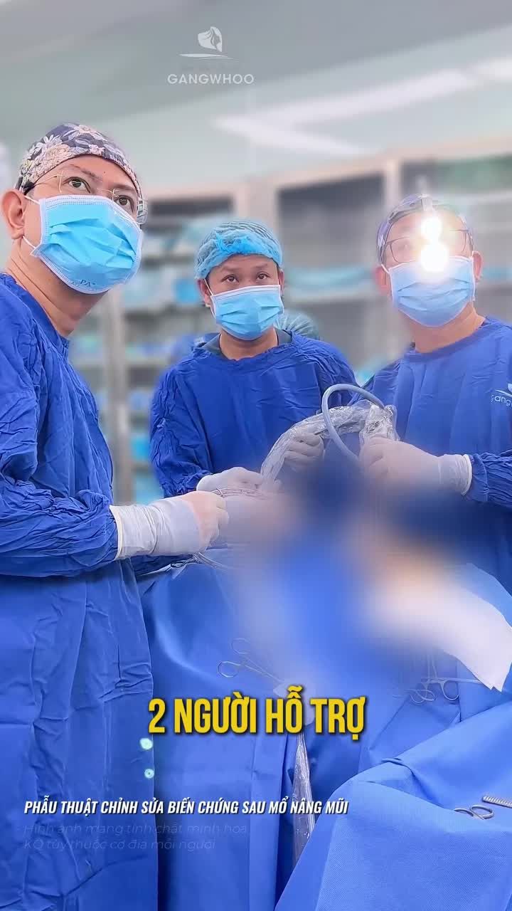 Sửa mũi lại bằng sụn sườn tự thân giải cứu mũi biến chứng co rút nặng sau nhiều lần nâng mũi