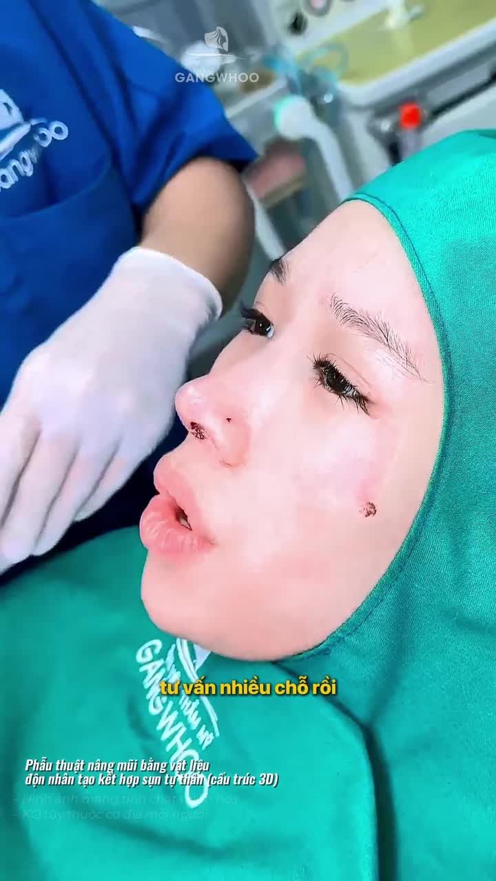 Màn "F5 dáng mũi" khiến chính chủ cũng phải bất ngờ