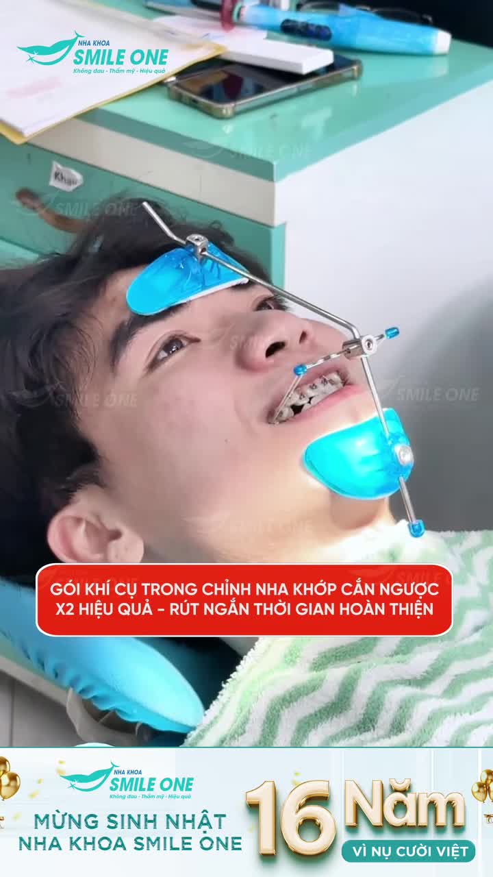 Nếu đeo mắc cài đơn thuần chưa thể giúp bạn cải thiện hàm răng thì với sự hỗ trợ của khí cụ, sự hiệu quả sẽ được nhân đôi và rút ngắn cả thời gian chỉnh nha của bạn.