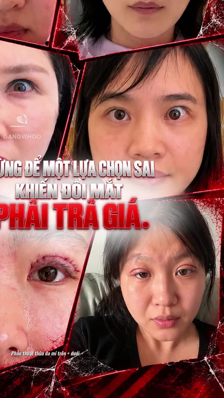 Đừng để một lựa chọn sai khiến đôi mắt phải trả giá