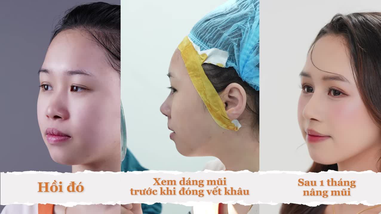 Một lựa chọn làm đẹp, một diện mạo mới.
