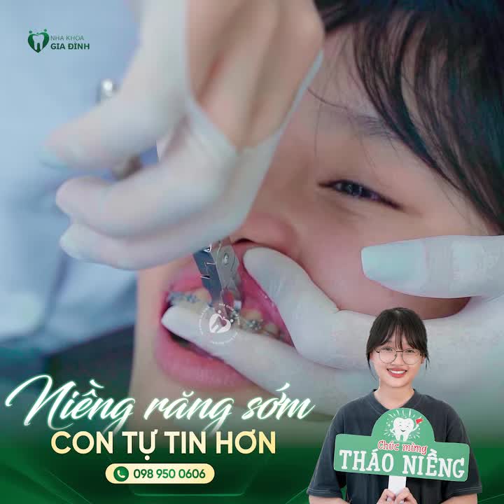 TỪNG TỰ TI VÌ KHỚP CẮN NGƯỢC, HƯƠNG LY GIỜ ĐÃ CÓ NỤ CƯỜI ĐÚNG NHƯ MONG ƯỚC!