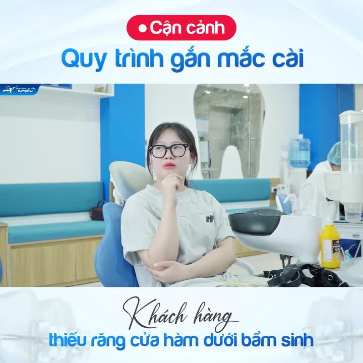 CẬN CẢNH QUY TRÌNH GẮN MẮC CÀI CHO KHÁCH HÀNG THIẾU RĂNG CỬA BẨM SINH