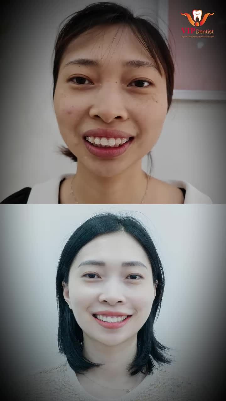 CHUYÊN MỤC FLEX NHỮNG CA NIỀNG XUẤT SẮC THÁNG 8!