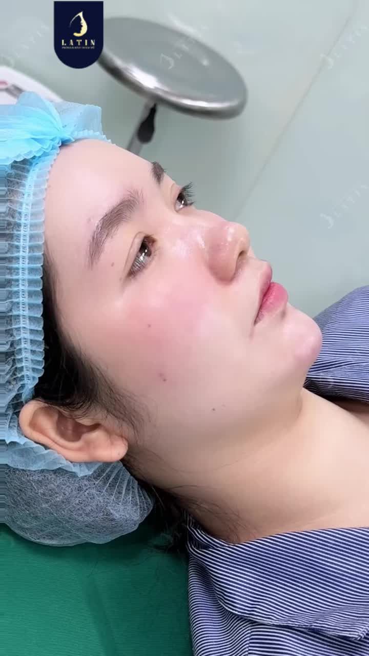 MŨI CAO VỪA ĐỦ, TỰ NHIÊN THEO YÊU CẦU