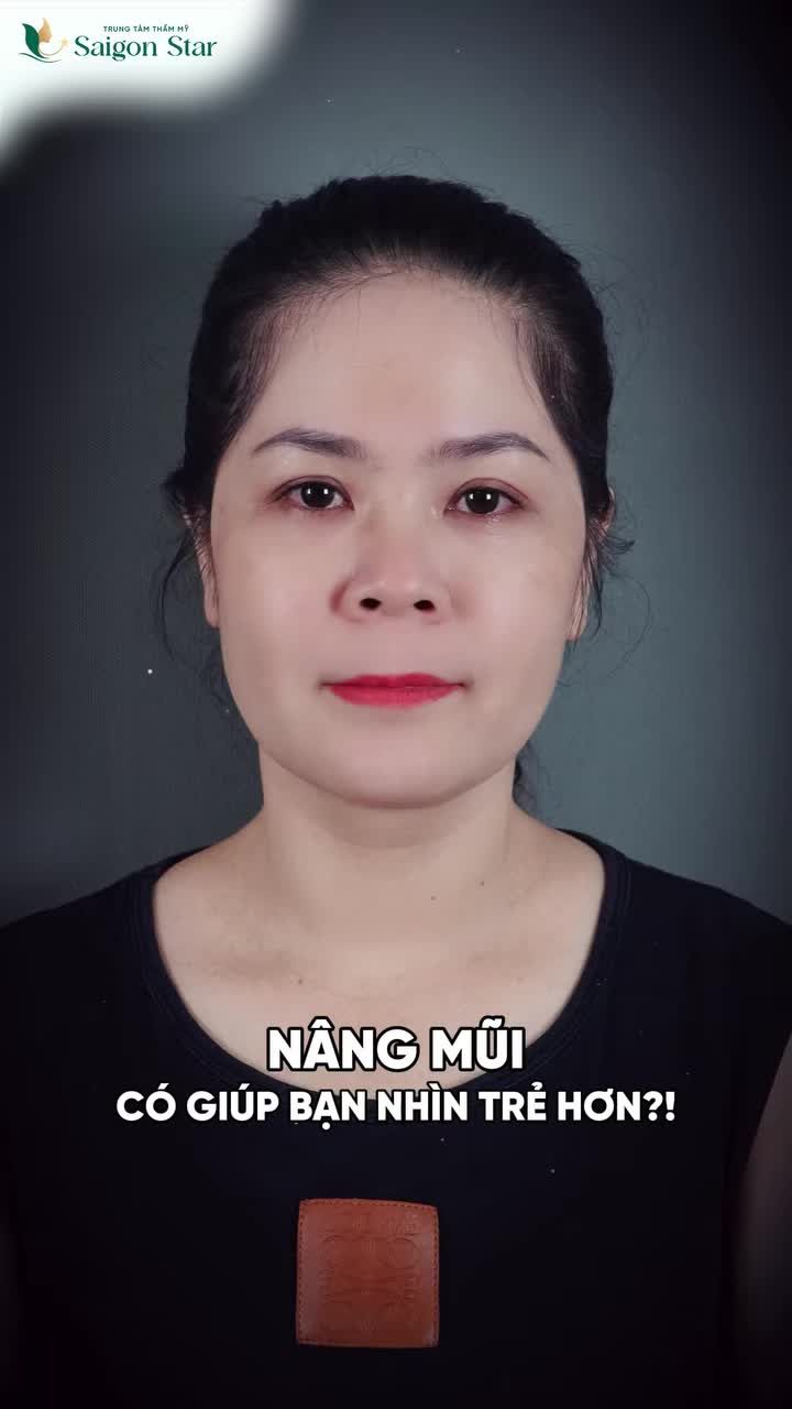 Chị Huyền Vy tự tin rạng ngời ngày tháo nẹp cắt chỉ.