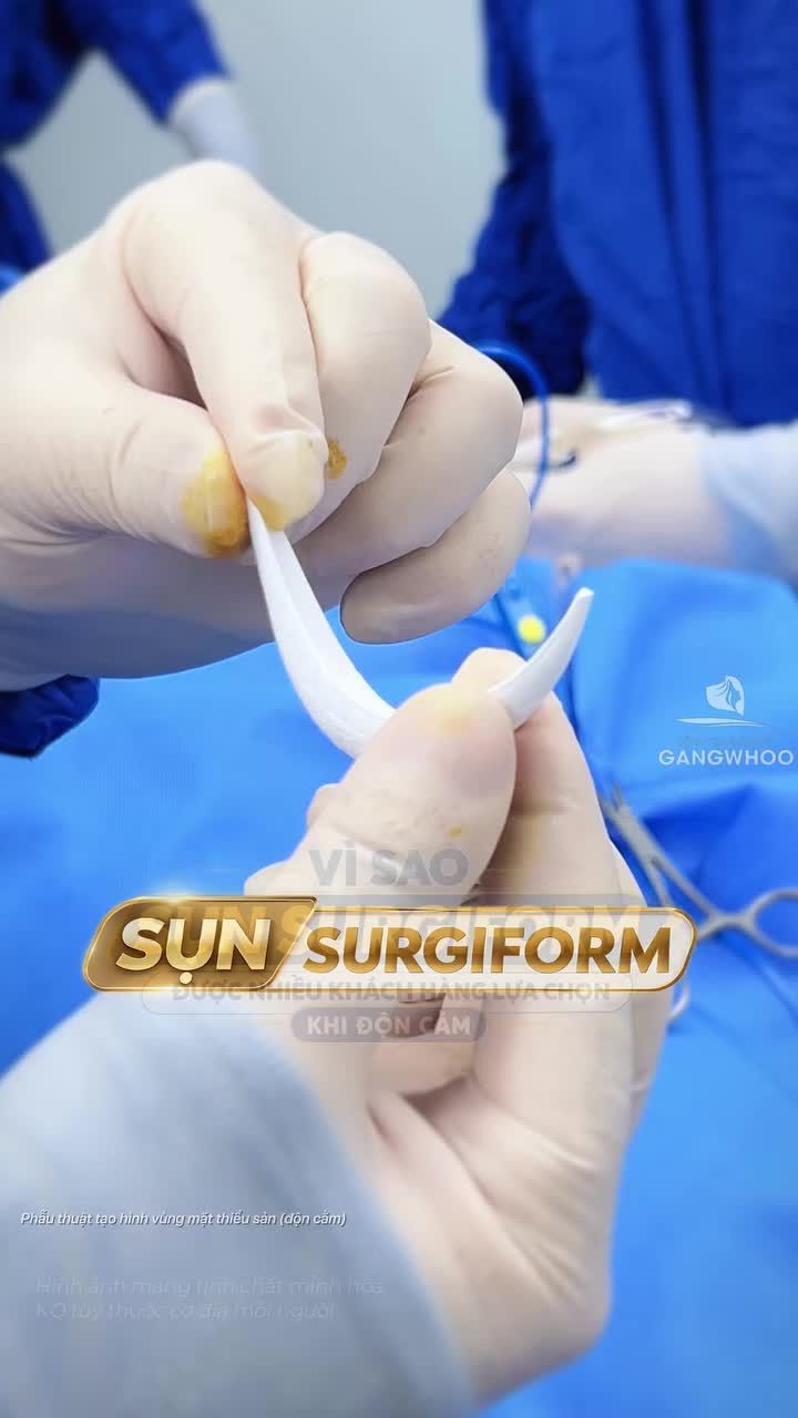 Vì sao sụn Surgiform được nhiều khách hàng lựa chọn khi độn cằm
