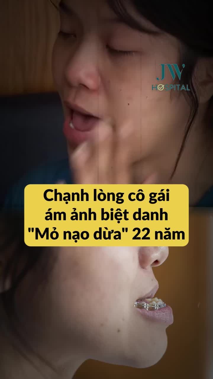 CÔ GÁI GEN Z KHÉP LẠI 22 NĂM MẶC CẢM VỚI BIỆT DANH “MỎ NẠO DỪA” SAU PHẪU THUẬT HÀM MÓM TẠI JW