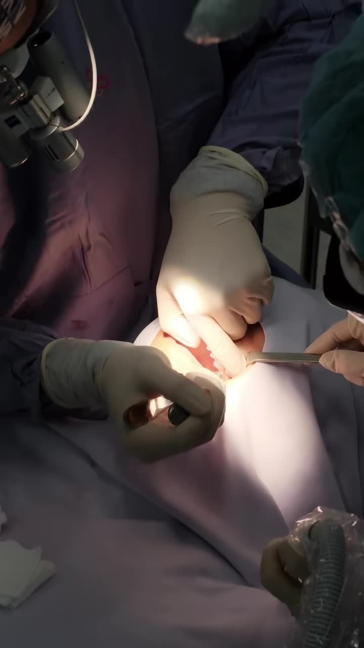 NHỔ 4 RĂNG KHÔN LÀ TRẢI NGHIỆM NHƯ THẾ NÀO??