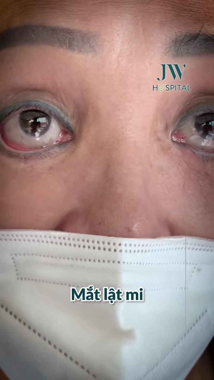 MẤT 35 TRIỆU CĂNG CHỈ DỎM, MẮT LẬT MI ĐỎ NHƯ MÁU - NỮ VIỆT KIỀU MỸ VỀ NƯỚC CẦU CỨU BÁC SĨ TÚ DUNG