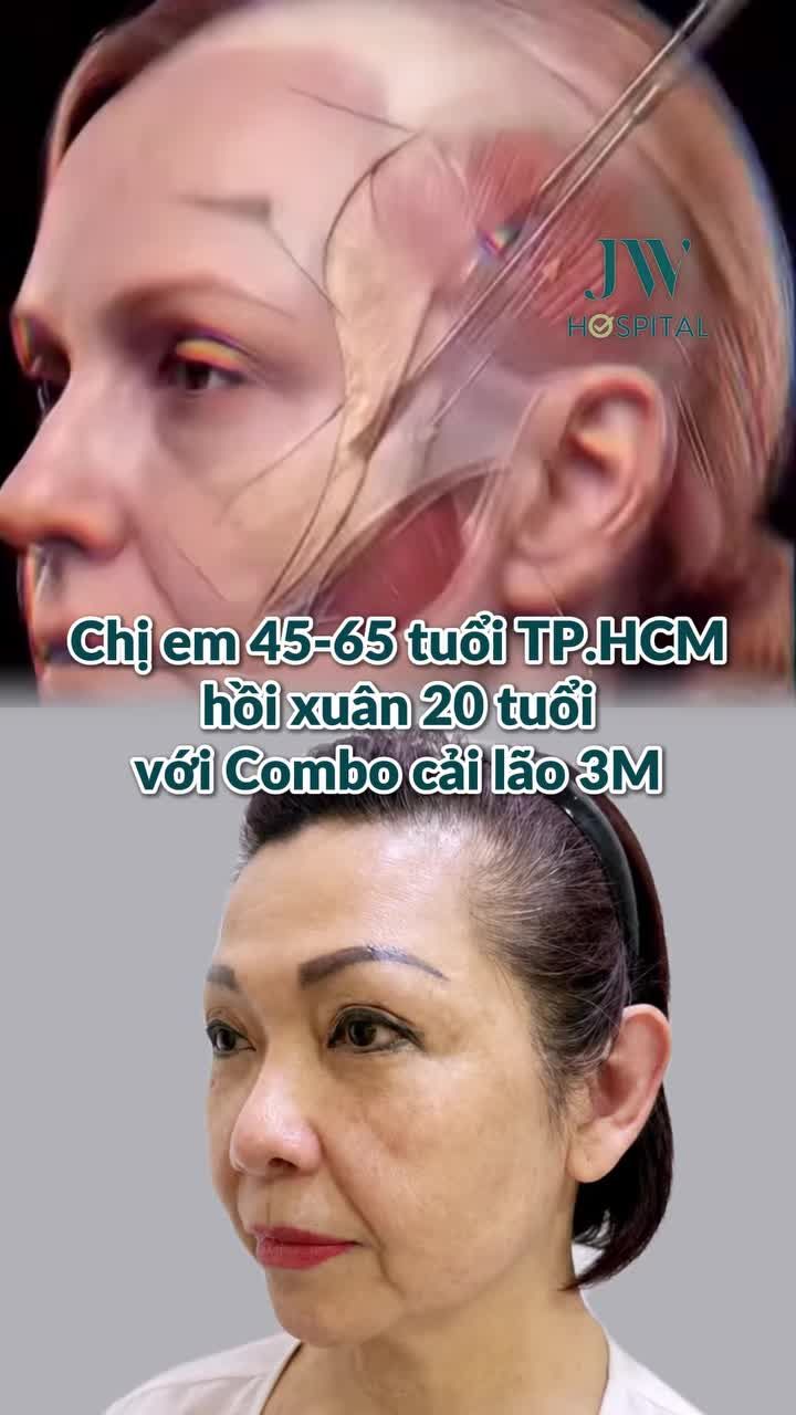 KHÔNG QUẢNG CÁO! HÀNG NGÀN CHỊ EM 45-65 TUỔI TP.HCM TRẺ LẠI 20 NĂM SAU COMBO CẢI LÃO 3M TẠI JW