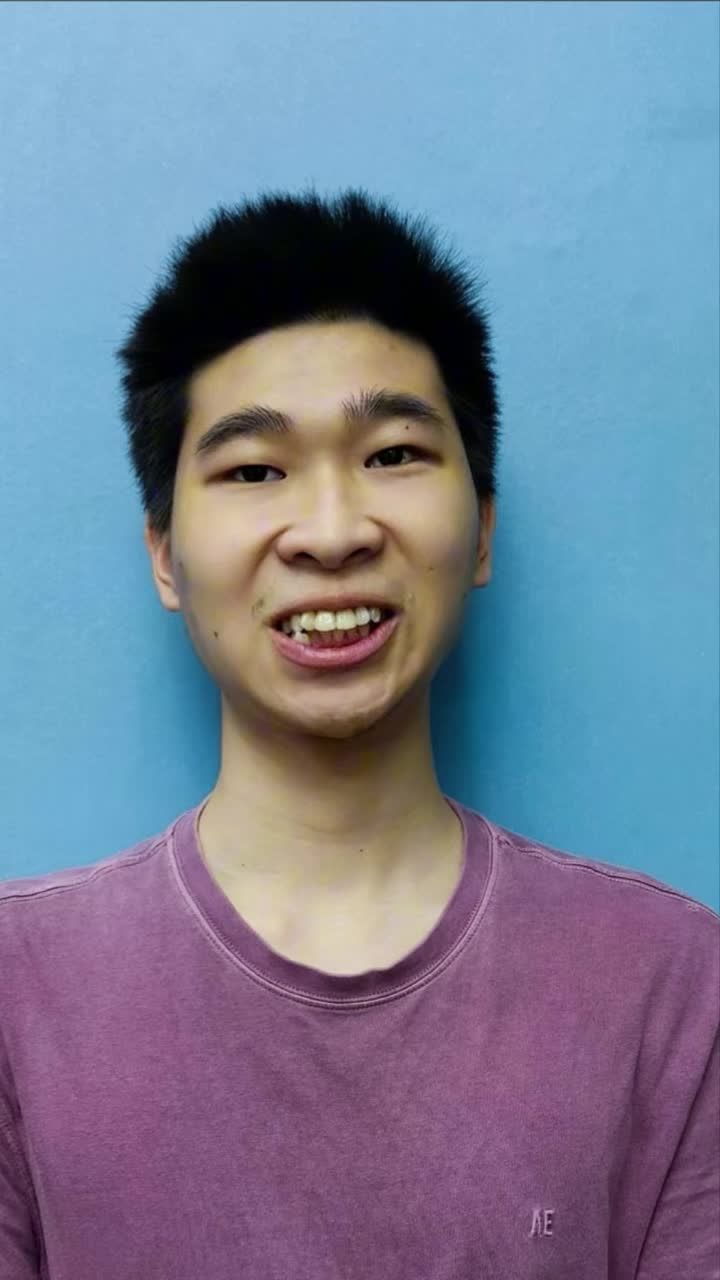 Smile One ghi nhận 1 ca biến hoá thành hot boy chỉ sau 2 năm niềng răng