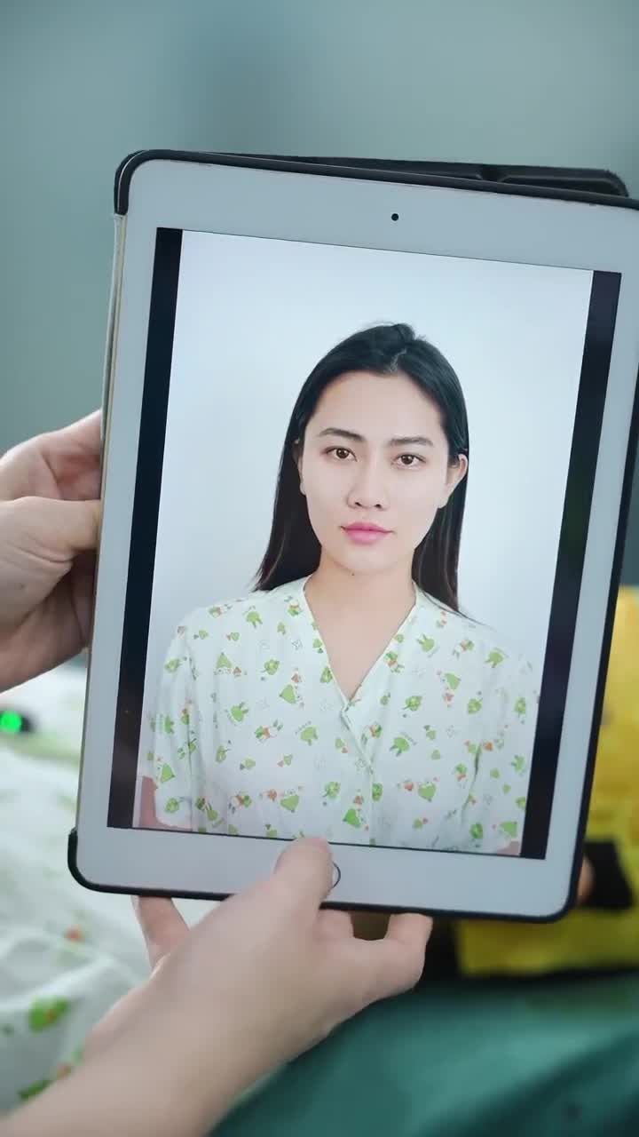 KẾT QUẢ NÂNG MŨI CẤU TRÚC DR.HOẠT - KHẮC PHỤC BIẾN CHỨNG KH. TRÚC QUỲNH (ĐỒNG THÁP)