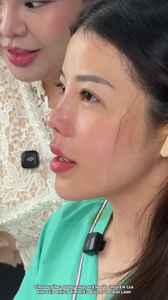 NÂNG MŨI CẤU TRÚC KẾT HỢP CHỈNH XƯƠNG – KIẾN TẠO DÁNG MŨI THANH TÚ, GƯƠNG MẶT CÂN ĐỐI