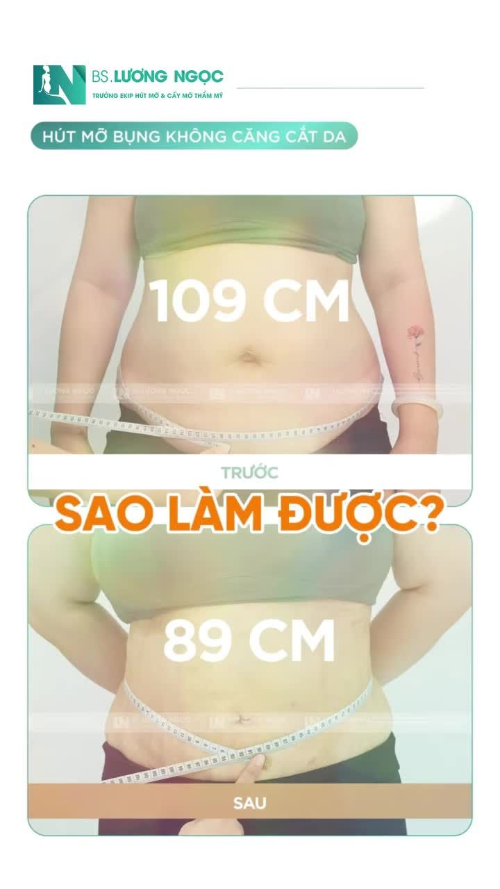 GIAM MỠ BỤNG 109CM → 89CM MÀ KHÔNG ĐỂ LẠI SEO?