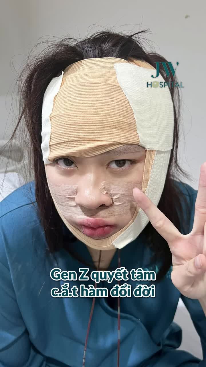NỮ VIỆT KIỀU MỸ XOÁ HÀM MÓM, MẶT LỆCH – LẤY LẠI GƯƠNG MẶT HÀI HÒA SAU PHẪU THUẬT TẠI JW
