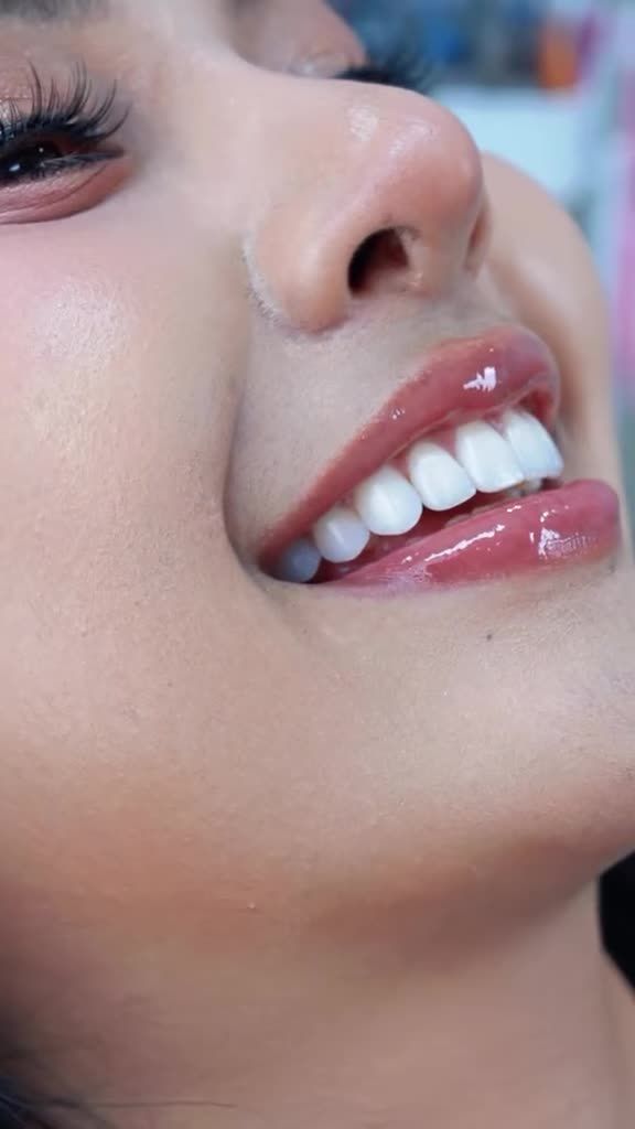 "DÁN VENEER: NÊN CHỌN TRẮNG SÁNG NỔI BẬT HAY TỰ NHIÊN GIỐNG RĂNG THẬT?"