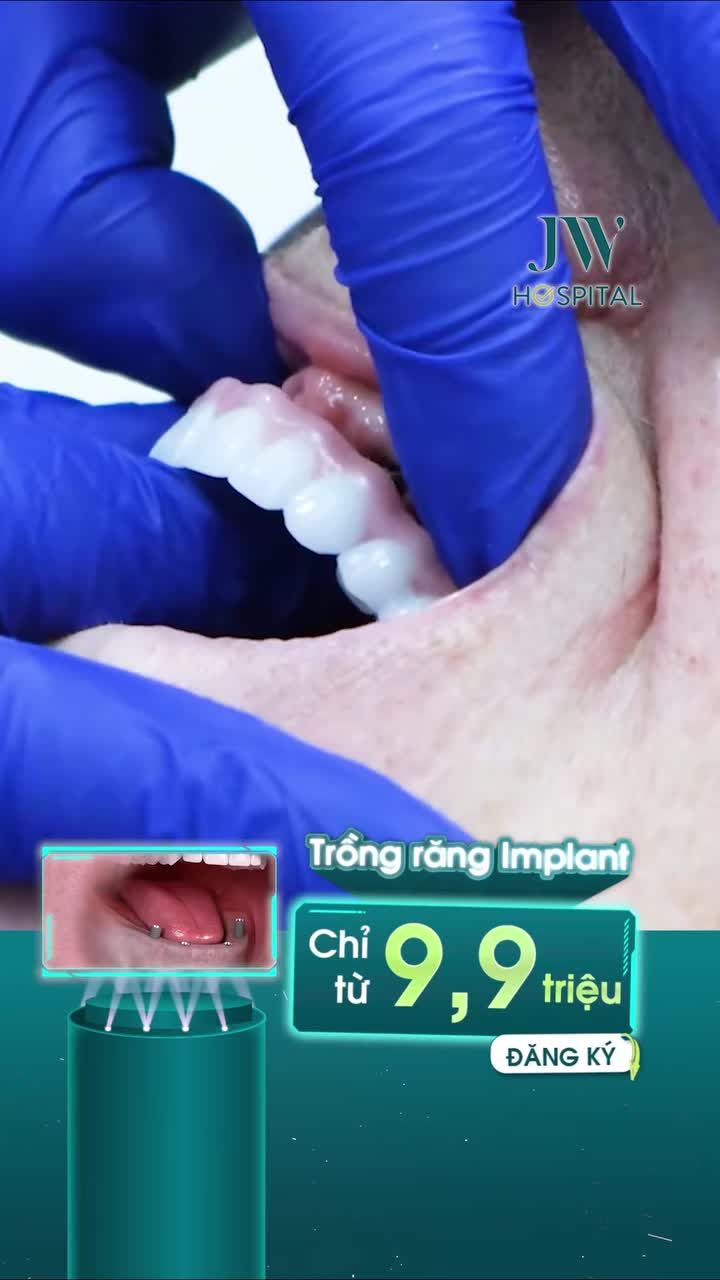 TIN VUI: TẶNG CÔ CHÚ U50 - U80 TRỒNG RĂNG IMPLANT CHỈ TỪ 9,999 TRIỆU - HẾT NỖI LO MẤT RĂNG
