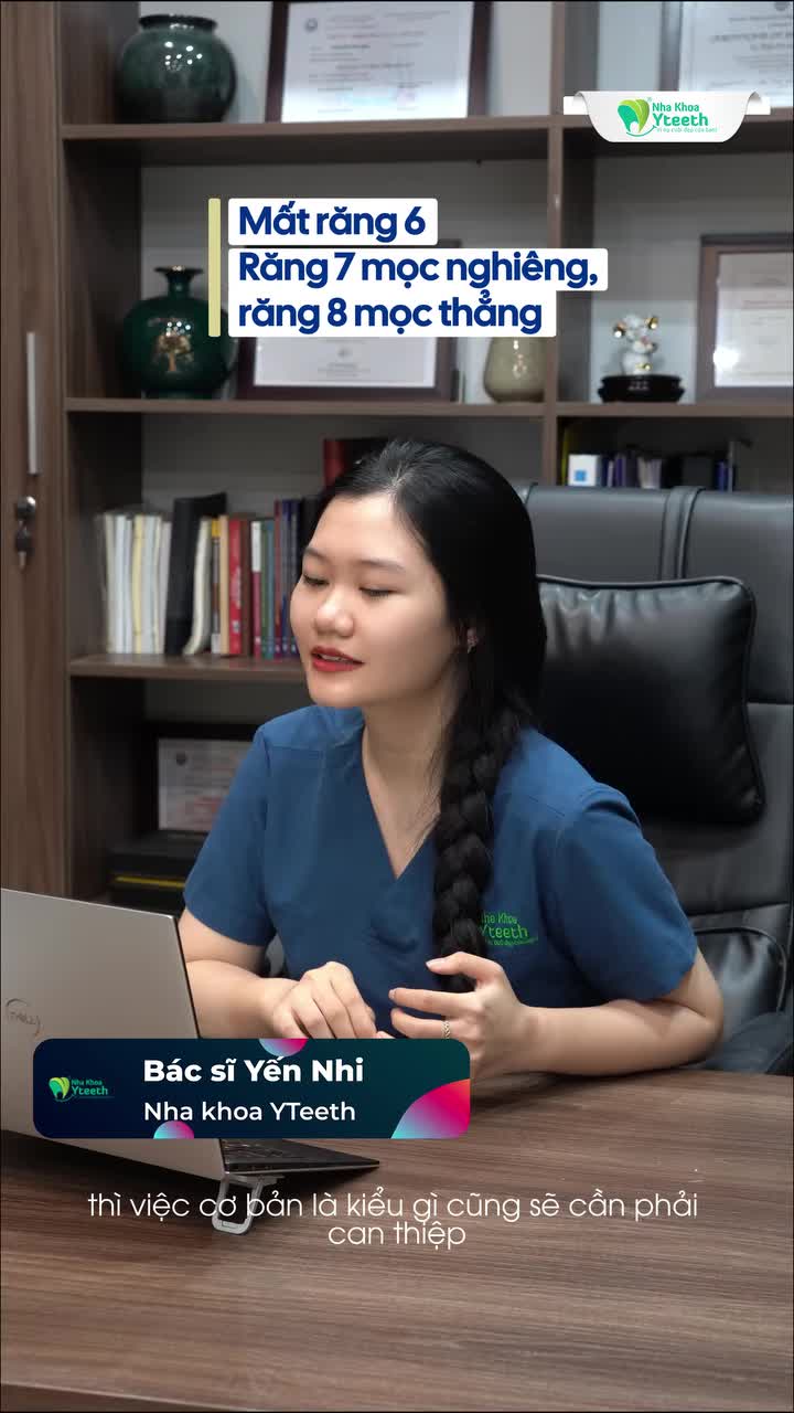 Mất răng 6, Răng 7 mọc nghiêng, Răng 8 mọc thẳng thì có niềng được không ?