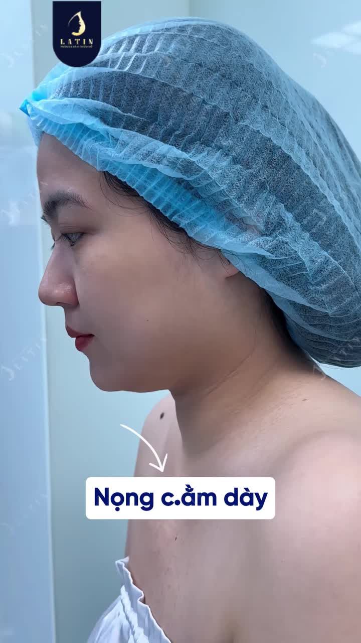 GÓC NGHIÊNG MẤT NÉT VÌ NỌNG CẰM?