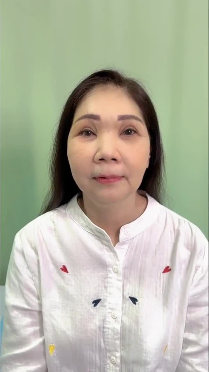 CẬN CẢNH nhan sắc mới của nữ đại gia Quận 8 U60 sau XÓA NHĂN CAU MÀY tại Bệnh viện JW