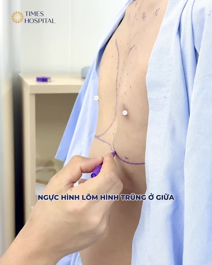 Khoảnh khắc đo đạc cùng ThS.BS Lê Hữu Điền trước giờ G!