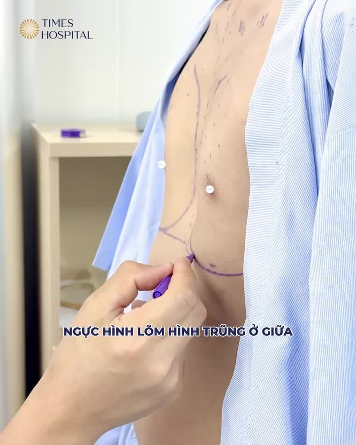 Khoảnh khắc đo đạc cùng ThS.BS Lê Hữu Điền trước giờ G!