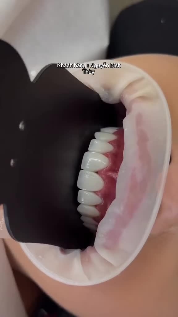 "TỰ TIN TỎA SÁNG Ở MỌI GÓC NHÌN — CHÚC MƯỜNG NỤ CƯỜI MỚI CỦA CHỊ NGUYỄN BÍCH THÙY!"