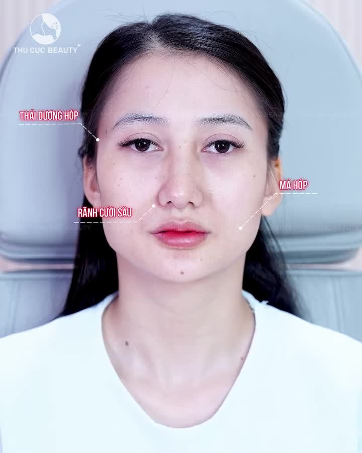 MẶT VỪA HÓP VỪA LỆCH THÌ PHẢI LÀM SAO?