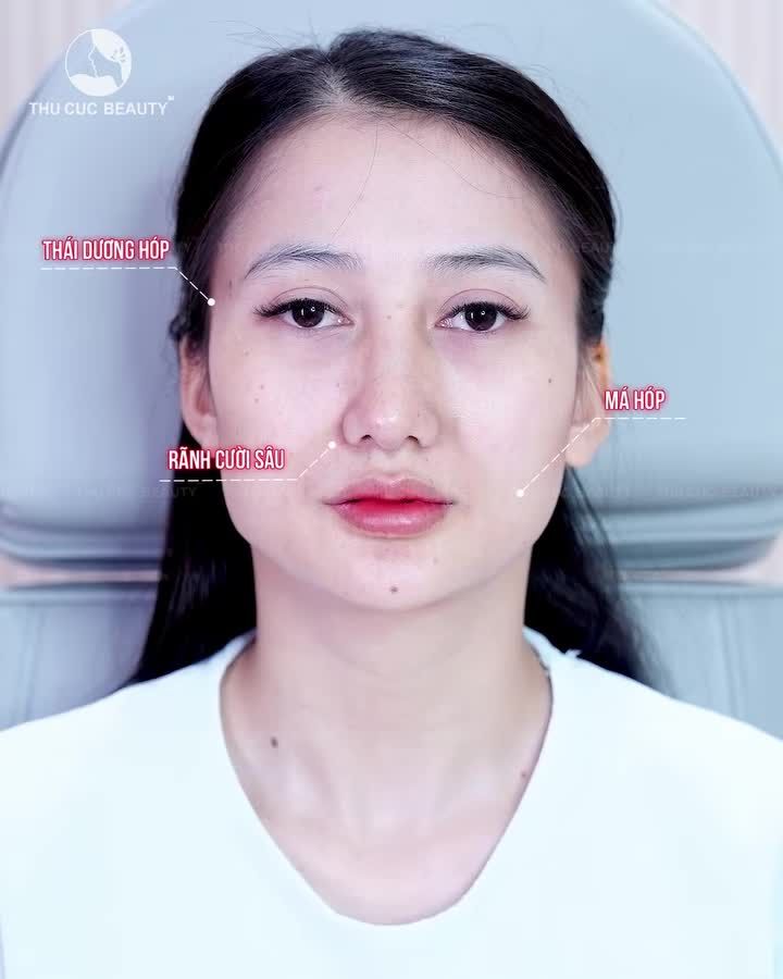 MẶT VỪA HÓP VỪA LỆCH THÌ PHẢI LÀM SAO?