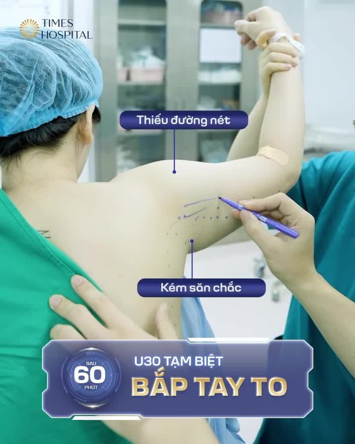 HÚT MỠ BẮP TAY - GỌN NGAY TỨC THÌ!