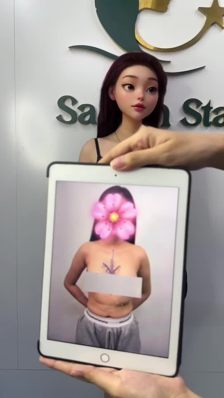 14 ngày NÂNG  NGỰC SỬA LẠI  DR. HOẠT