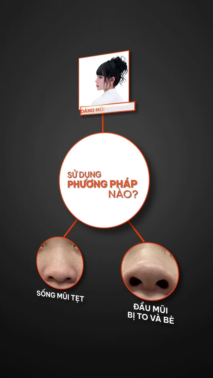 Mũi tẹt, đầu mũi to bè thì nên nâng mũi phương pháp gì. Xem hết video để có góc nhìn chuyên môn từ Tiến sĩ Tống Hải