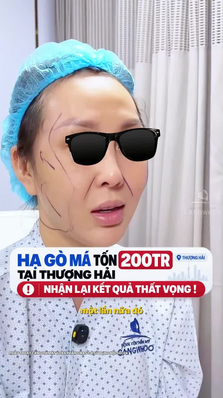 Tốn 200Tr làm đẹp tại Thượng Hải và cái kết thất vọng da chảy xệ sau hạ gò má.